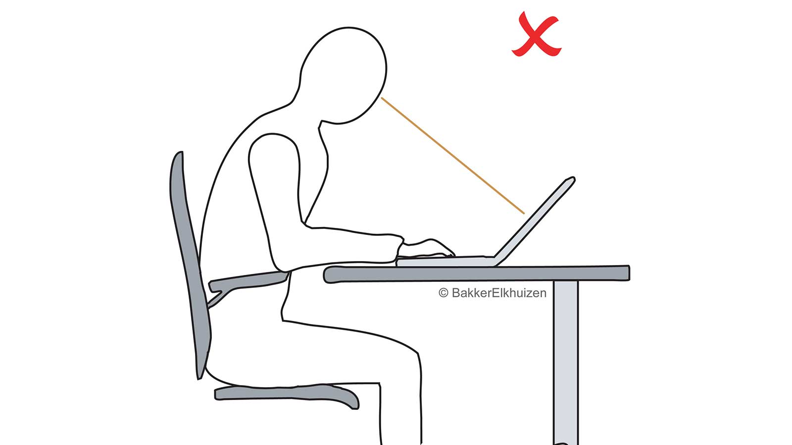 Zeichnung falsch: belastende Arbeitshaltung ohne Laptop-Halter